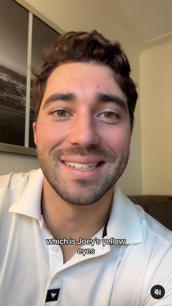 'Bachelor' star Joey Graziadei addresses his 'yellow eyes'