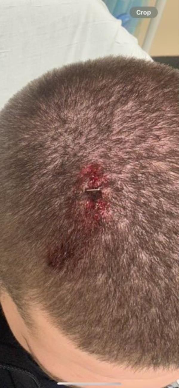 The officer was assaulted at the end of the Saturday demonstration, suffering a cut that required two staples.